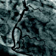使用自适应直方图均衡提高对比度 使用自适应直方图均衡提高对比度
